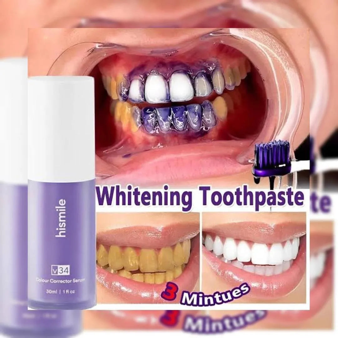Hismile Tooth Whitening